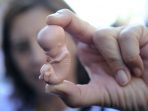Ilustrasi aborsi. PEDRO ARMESTRE AFP Getty Images Ilustrasi aborsi