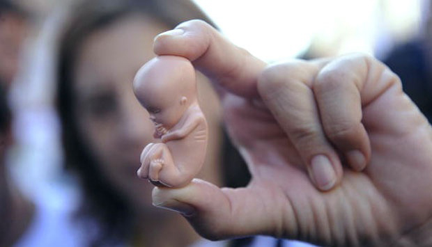 Ilustrasi aborsi